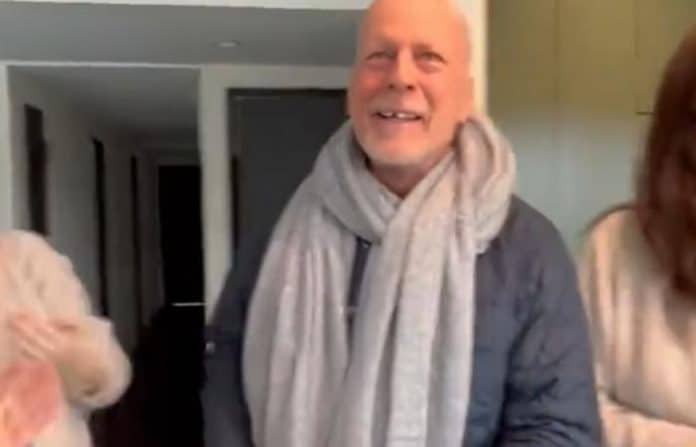 Bruce Willis is missing a tooth